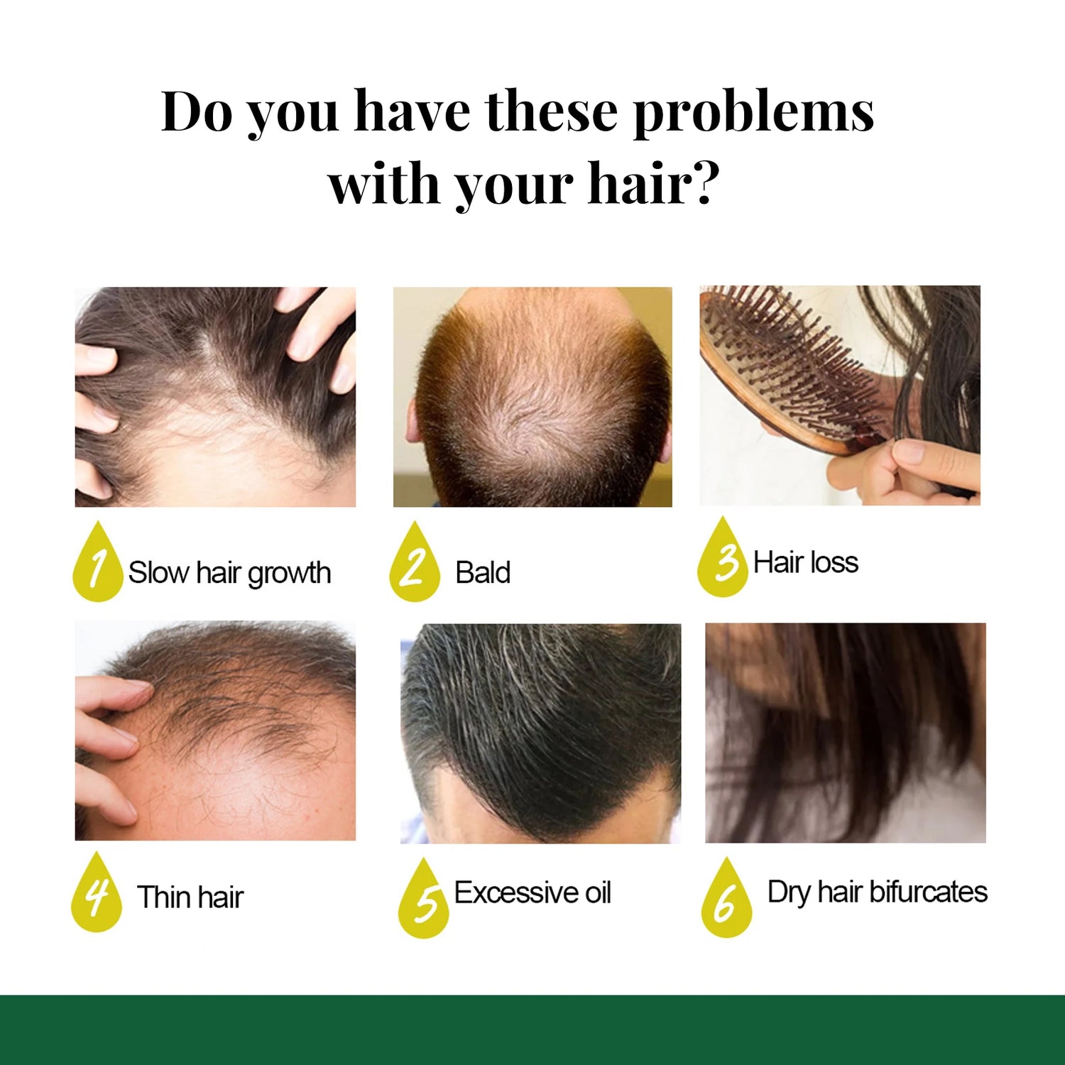 Ginger Care Hair Spray Hair Growth Essence Nourish Hair Roots Massage Scalp Repair 